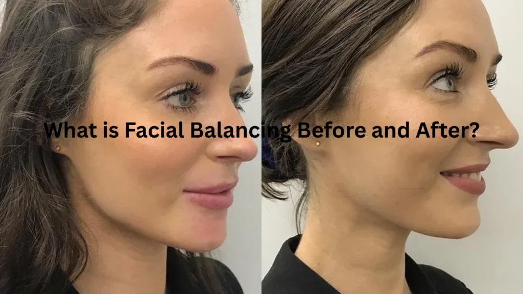 What is Facial Balancing Before and After?
