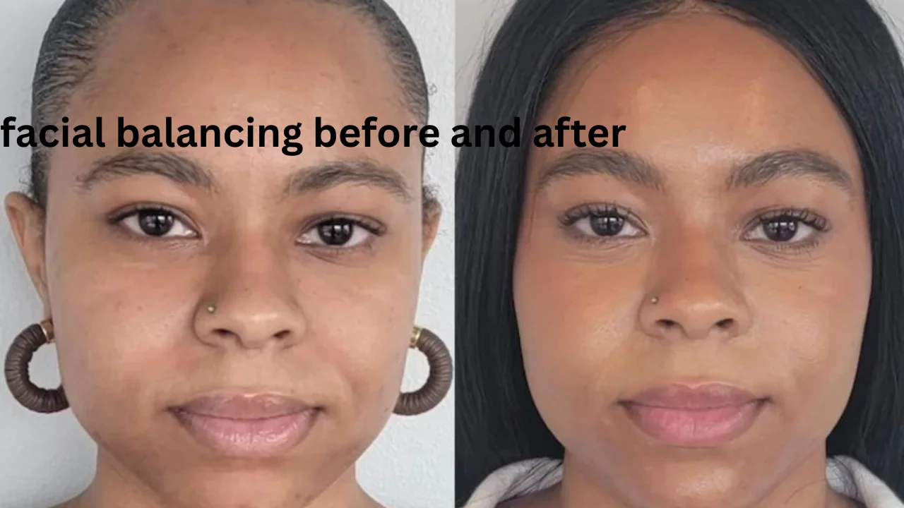 facial balancing before and after