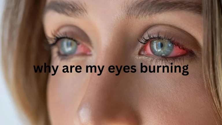why are my eyes burning